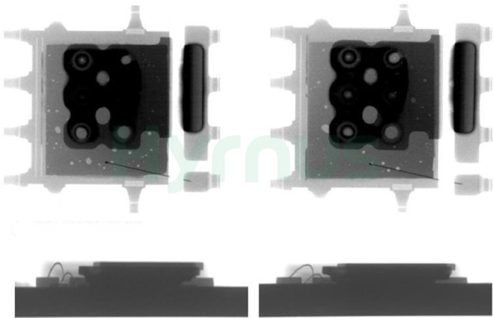 X-ray inspection of voids X-ray inspection of voids